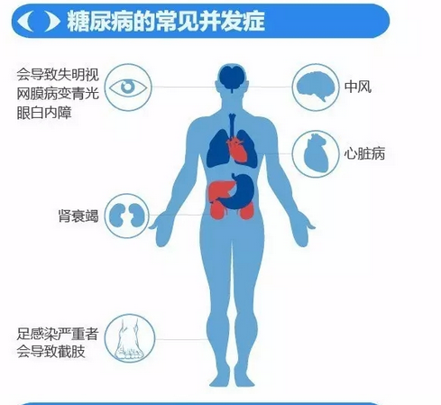 你造嗎？糖尿病晚期眼睛會致盲！