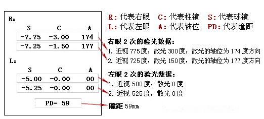 眼科醫(yī)生教你如何一分鐘看懂驗光單！